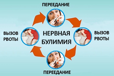 Лечение булимии в Пензе